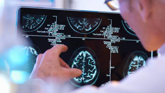 G3KR64 Radiologist assessing CT brain scan