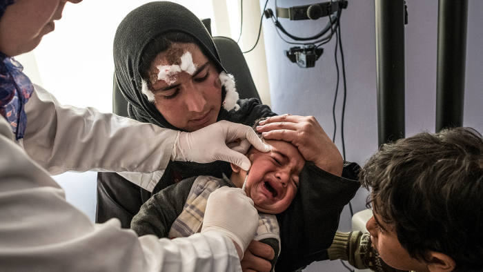 Wesal Daher’s son Khaled is treated for cutaneous leishmaniasis at a hospital in Tripoli, northern Lebanon