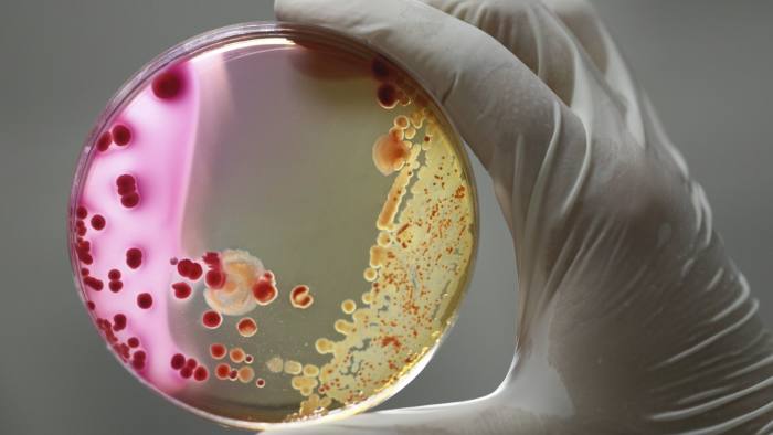 Bacteria macro photographed media in petri dishes in the laboratory
