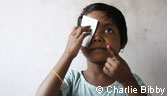 Sightsavers appeal