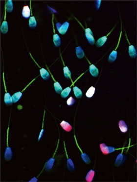 Sperm under the York microscope, with colour indicating viability