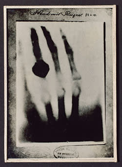Wilhelm Röntgen’s radiograph of his wife’s hand taken in 1895