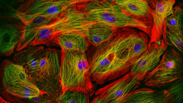 Human heart muscle cells grown from stem cells