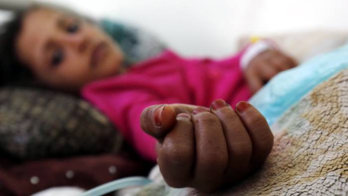 epa06441108 A malnourished child receives treatment amid worsening malnutrition at the emergency ward of a hospital in Sana'a, Yemen, 15 January 2018. According to reports, an estimated 3.3 million children in Yemen are acutely malnourished, including 462 thousand children under the age of five who face severe acute malnutrition after two and a half years of escalating conflict between Yemen's Saudi-backed government forces and the Houthi rebels.  EPA/YAHYA ARHAB