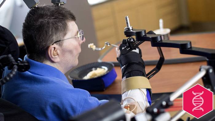 Braingate Clinical Trial: Brain Implants Allow Paralyzed Patients to Move Limbs