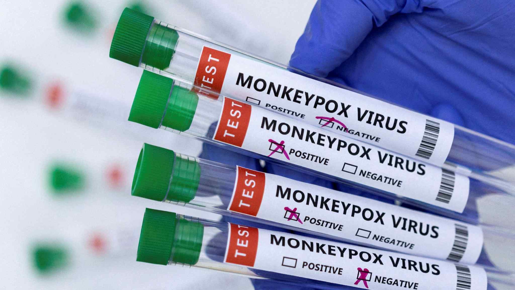 EU pursues centralised purchase of monkeypox vaccine and antiviral drug