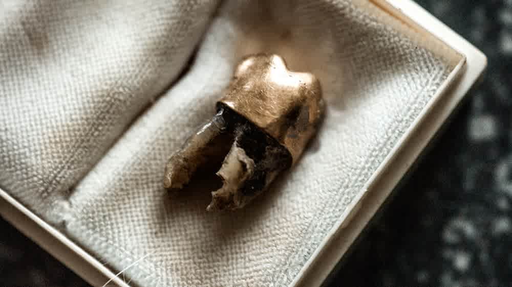 The 60-year, 4,000-mile journey home of Lumumba’s tooth