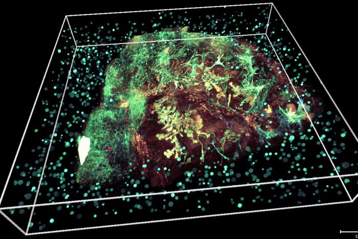 A 3D image representing data collected on tumour growth