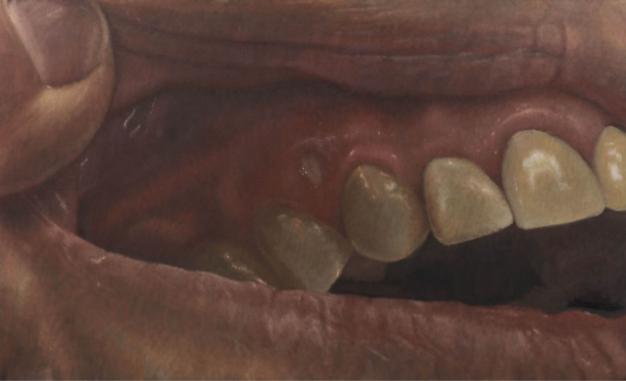 Close-up drawing of a person's mouth with bare teeth