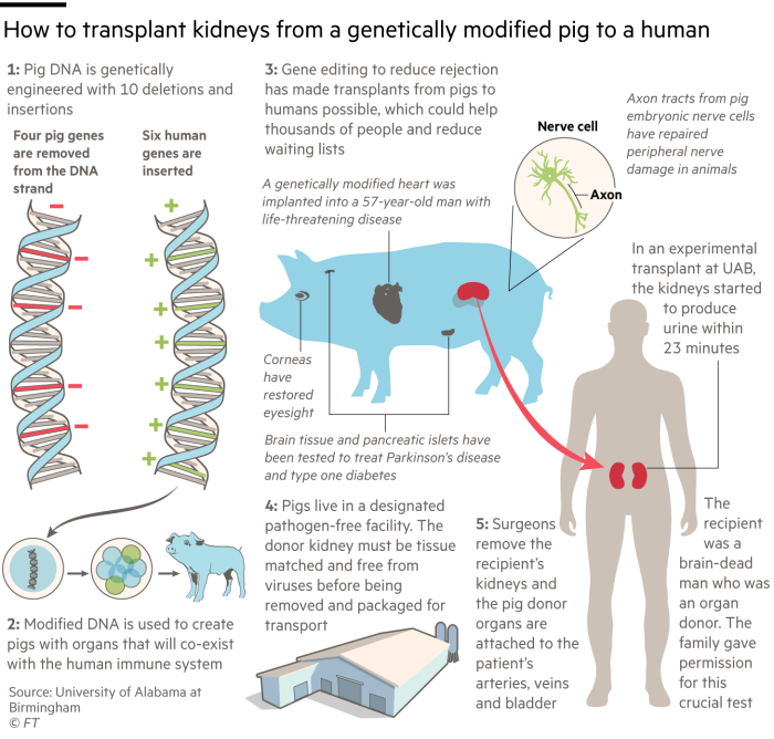 Graphic showing how to transplant kidneys from a genetically modified pig to a human G0181_22X